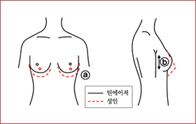 바스트 형태1